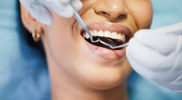 Best Chipped Tooth Repair Near Me  in Northampton, PA